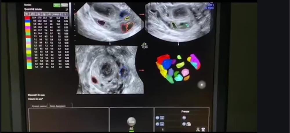 Alviggi-Training-Center-immagini-5-Copy Inaugurato a Napoli l'International Training Center for Medically Assisted Reproduction